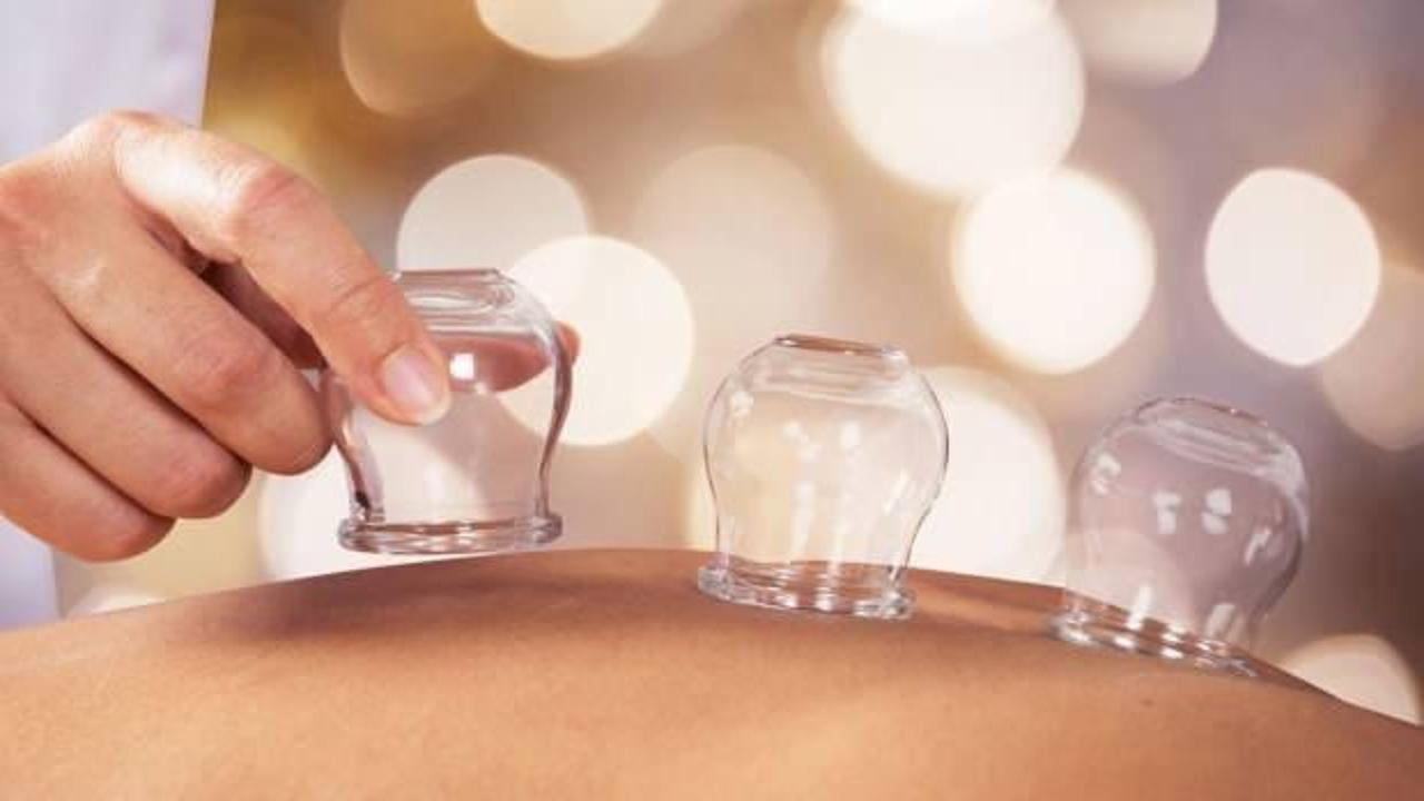 Manevi hacamat bölgeleri ve faydaları! Hacamatın manevi sırları ve faydaları nelerdir?