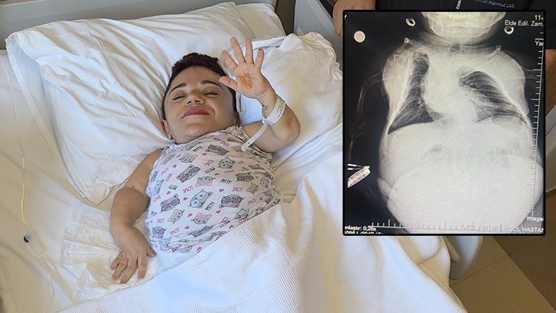 24 kilo ağırlığındaki Nurdan’ın yumurtalıklarından 3 kilo kist çıkarıldı