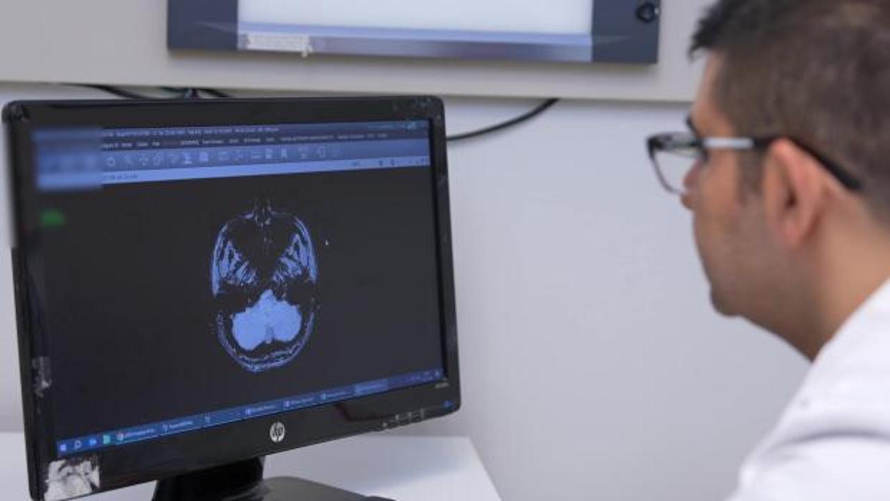 İnme, her yaşta görülebilir: İlk 24 saat hayati önem taşıyor