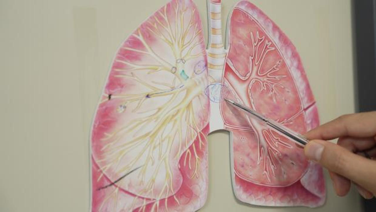 KOAH ölüm listesinde 3. sıraya yerleşti: Risk kış aylarında daha da artıyor!